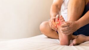 Gout (Inflammatory Joint Disorder)